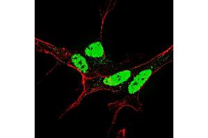 Fluorescent confocal image of SY5Y cells stained with (ABIN390032 and ABIN2839782) Phospho-Nanog-S71 antibody. (Nanog antibody  (pSer71))