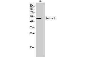 Western Blotting (WB) image for anti-Septin 6 (SEPT6) (Internal Region) antibody (ABIN3186911) (Septin 6 antibody  (Internal Region))