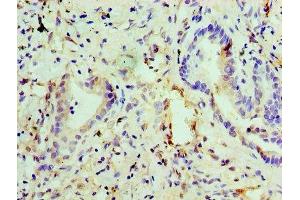 Immunohistochemistry of paraffin-embedded human lung tissue using ABIN7151444 at dilution of 1:100 (PHD1 antibody  (AA 283-407))