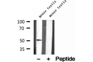 Western blot analysis of extracts of mouse testis tissue, using IFT52 antibody. (IFT52 antibody  (Internal Region))