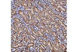 IHC analysis of CBR1 using anti-CBR1 antibody (ABIN7600015). (CBR1 antibody  (AA 14-262))