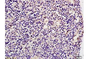 Formalin-fixed and paraffin embedded mouse embryo labeled with Anti GLUT8 Polyclonal Antibody, unconjugated (ABIN705746) at 1:200 followed by incubation with conjugated secondary antibody and DAB staining (SLC2A8 antibody  (AA 401-477))