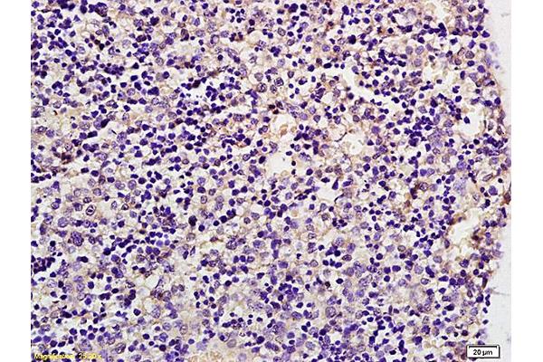 SLC2A8 antibody  (AA 401-477)
