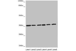Western blot All lanes: ETFA antibody at 4. (ETFA antibody  (AA 1-333))