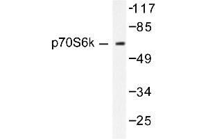 Image no. 1 for anti-Ribosomal Protein S6 Kinase, 70kDa, Polypeptide 1 (RPS6KB1) antibody (ABIN271771) (RPS6KB1 antibody)