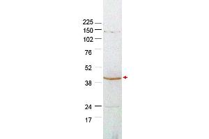 Image no. 1 for anti-Plasminogen Activator Inhibitor 2 (SERPINB2) (Internal Region) antibody (ABIN401463) (SERPINB2 antibody  (Internal Region))
