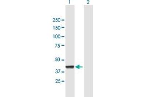 Western Blot analysis of CNP expression in transfected 293T cell line by CNP MaxPab polyclonal antibody. (Cnpase antibody  (AA 1-421))