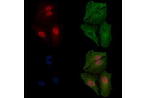 ABIN7094385 and ABIN7098432 staining  cells by IF/ICC.