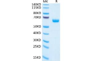 SDS-PAGE (SDS) image for Placenta Growth Factor (PGF) (AA 19-221) protein (Fc Tag) (ABIN7275444)