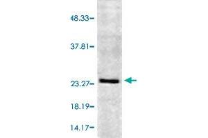 Western blot analysis of human cell line mix with RAB5A polyclonal antibody (PAB29000) at 1:1000 dilution. (RAB5 antibody  (HRP))