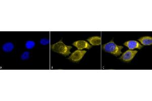 Immunocytochemistry/Immunofluorescence analysis using Rabbit Anti-SOD (Mn) Polyclonal Antibody (ABIN361655 and ABIN361656). (SOD2 antibody)