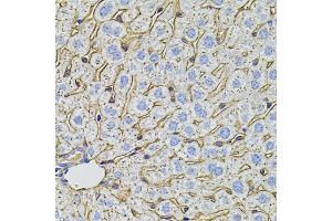 Immunohistochemistry of paraffin-embedded mouse liver using PCSK9 antibody. (PCSK9 antibody)