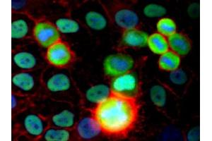 Immunofluorescence staining (human cervix carcinoma cells) Immunofluorescence staining of HeLa human cervix carcinoma cell line using purified anti-Ku Antigen (MEM-54) (detection by Goat anti-mouse IgG2a Alexa Fluor ® 488; green). (X-Ray Repair Cross Complementing 5 antibody)