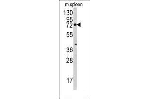Image no. 1 for anti-Mannosyl (Beta-1,4-)-Glycoprotein beta-1,4-N-Acetylglucosaminyltransferase (MGAT3) (N-Term) antibody (ABIN357703) (MGAT3 antibody  (N-Term))