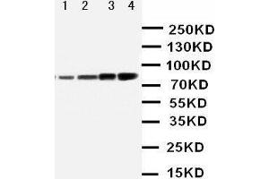 Anti-PI 3 Kinase p85 alpha antibody, Western blotting Lane 1: MCF-7 Cell Lysate Lane 2: HELA Cell Lysate Lane 3: COLO Cell Lysate Lane 4: SW620 Cell Lysate