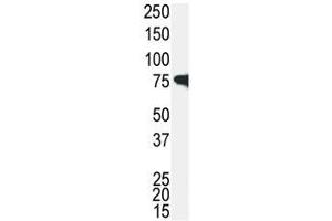 Western blot analysis of IRAK antibody and Jurkat cell lysate. (IRAK1 antibody  (AA 683-712))
