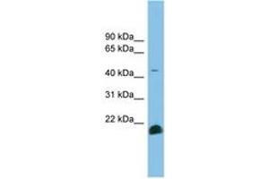 Image no. 1 for anti-Transforming Growth Factor, beta 2 (TGFB2) (AA 143-192) antibody (ABIN6744802) (TGFB2 antibody  (AA 143-192))