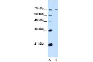 GALNT6 antibody used at 5 ug/ml to detect target protein. (GALNT6 antibody  (N-Term))