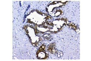 IHC analysis of NMI using anti-NMI antibody (ABIN3043451). (NMI antibody  (AA 2-307))