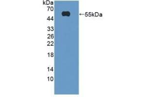 Detection of Recombinant TREM2, Mouse using Polyclonal Antibody to Triggering Receptor Expressed On Myeloid Cells 2 (TREM2) (TREM2 antibody  (AA 1-227))