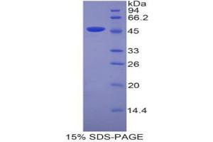 SDS-PAGE (SDS) image for Lipocalin 4 (LCN4) (AA 20-178) protein (His tag,GST tag) (ABIN2123180)