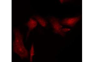 ABIN6269395 staining HT29 by IF/ICC. (FANCD2 antibody  (N-Term))