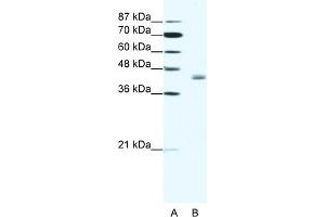 WB Suggested Anti-LDB2 Antibody Titration:  1. (LIM Domain Binding 2 Protein antibody  (C-Term))
