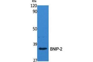Western Blot (WB) analysis of specific cells using BNIP-2 Polyclonal Antibody. (BNIP2 antibody  (Internal Region))