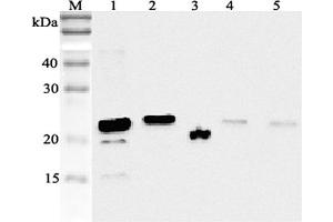 Western blot analysis using anti-RBP4 (human), pAb  at 1:2'000 dilution. (RBP4 antibody)