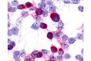 HEK293 expressing transfected CCR7 (CCR7 antibody  (C-Term))
