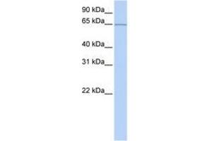Image no. 1 for anti-Pumilio RNA Binding Family Member 3 (PUM3) (AA 451-500) antibody (ABIN6740662) (KIAA0020 antibody  (AA 451-500))