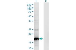 Western Blot analysis of BLOC1S2 expression in transfected 293T cell line by BLOC1S2 monoclonal antibody (M01), clone 8C10. (BLOC1S2 antibody  (AA 1-142))