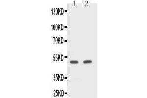 Anti-CD2 antibody, Western blotting Lane 1: Rat Spleen Cell Lysate Lane 2: NIH/3T3 Cell Lysate (CD2 antibody  (Middle Region))