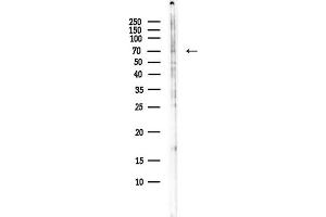 anti-RALBP1 Associated Eps Domain Containing Protein 2 (REPS2) (Internal Region) antibody