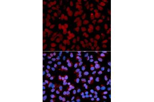 Immunofluorescence analysis of U2OS cell using TNFAIP3 antibody. (TNFAIP3 antibody)