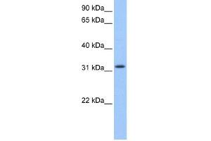 WB Suggested Anti-C14orf140 Antibody Titration: 0. (ZC2HC1C antibody  (N-Term))