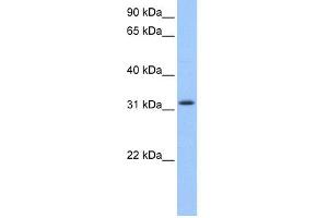 WB Suggested Anti-C14orf140 Antibody Titration: 0. (ZC2HC1C antibody  (N-Term))