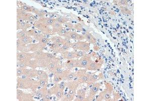 Immunohistochemistry of paraffin-embedded Human liver using DBH Polyclonal Antibody at dilution of 1:200 (40x lens). (DBH antibody)