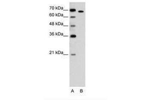 Image no. 2 for anti-RAR-Related Orphan Receptor A (RORA) (AA 239-288) antibody (ABIN205084) (RORA antibody  (AA 239-288))