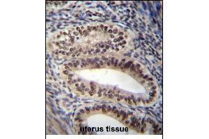 PGR/PR Antibody (Center) (ABIN656981 and ABIN2846164) immunohistochemistry analysis in formalin fixed and paraffin embedded human uterus tissue followed by peroxidase conjugation of the secondary antibody and DAB staining. (Progesterone Receptor antibody  (AA 349-377))