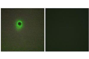 Immunofluorescence analysis of A549 cells, using HIPK4 antibody. (HIPK4 antibody  (C-Term))