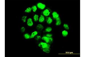 Immunofluorescence of monoclonal antibody to FOXA1 on A-431 cell. (FOXA1 antibody  (AA 367-472))
