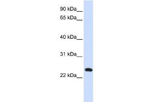 WB Suggested Anti-C20orf103 Antibody Titration:  0.