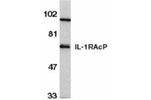 Western blot analysis of IL-1RAcP in HeLa whole cell lysate with AP30412PU-N IL-1RAcP antibody at 1/500 dilution. (FBXO43 antibody  (C-Term))