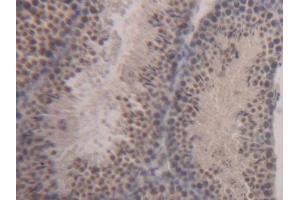DAB staining on IHC-P; Samples: Mouse Testis Tissue (STAT1 antibody  (AA 432-680))