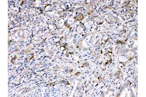 IHC analysis of Bax using anti-Bax antibody . (BAX antibody  (N-Term))