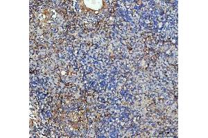 IHC analysis of ICAM1 using anti-ICAM1 antibody (ABIN5692991).