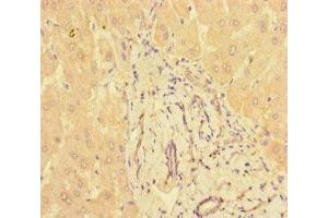 Immunohistochemistry of paraffin-embedded human liver tissue using ABIN7165948 at dilution of 1:100 (PPM1H antibody  (AA 73-289))