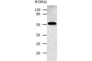 Gel: 10 % SDS-PAGE Lysate: 30 μg Human fetal brain tissue lysate Primary antibody: 1/500 dilution Secondary antibody: Donkey anti Rabbit IgG - H&L (HRP) at 1/3000 dilution Exposure time: 30 seconds (AAK1 antibody  (N-Term))