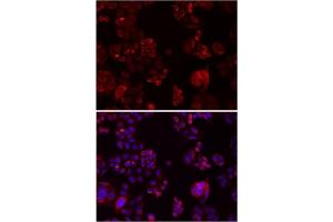 Immunofluorescence analysis of SW480 cells showing nuclear and cytoplasmic localization with NOTCH3 antibody 1:200 (top,red). (NOTCH3 antibody)